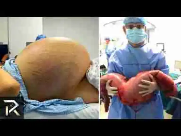 Video: Strange Things Discovered Inside People